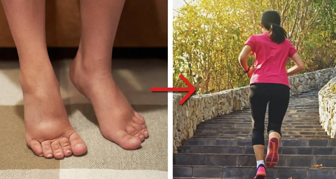 A person's swollen ankles, illustrating a common issue.