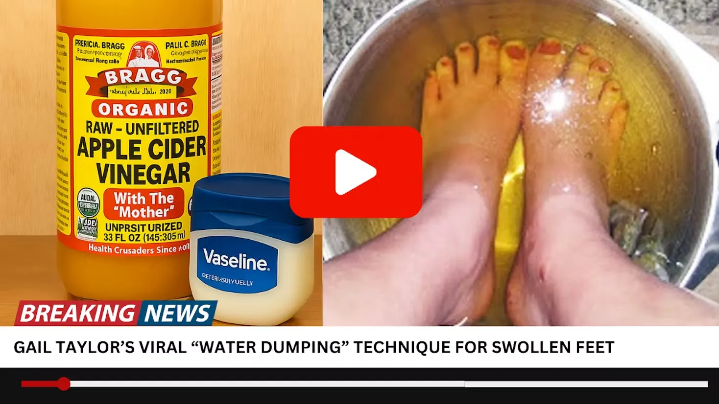 Before and after of swollen feet